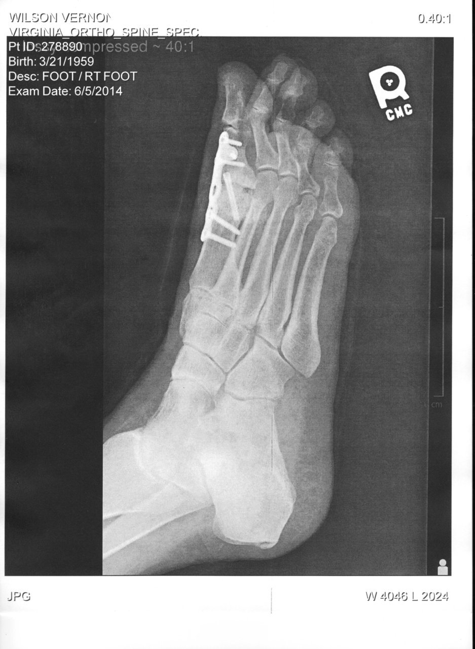 06052014 xray3.jpg