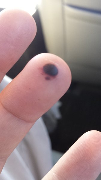 20151121_101243.jpg