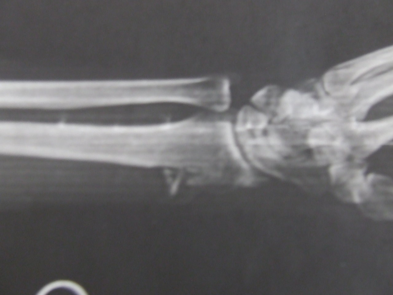 2015_0925wrist0001.jpg