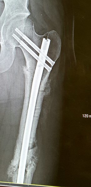 20161221_213534.jpg