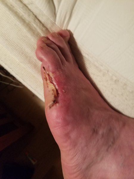 20170227_215645.jpg