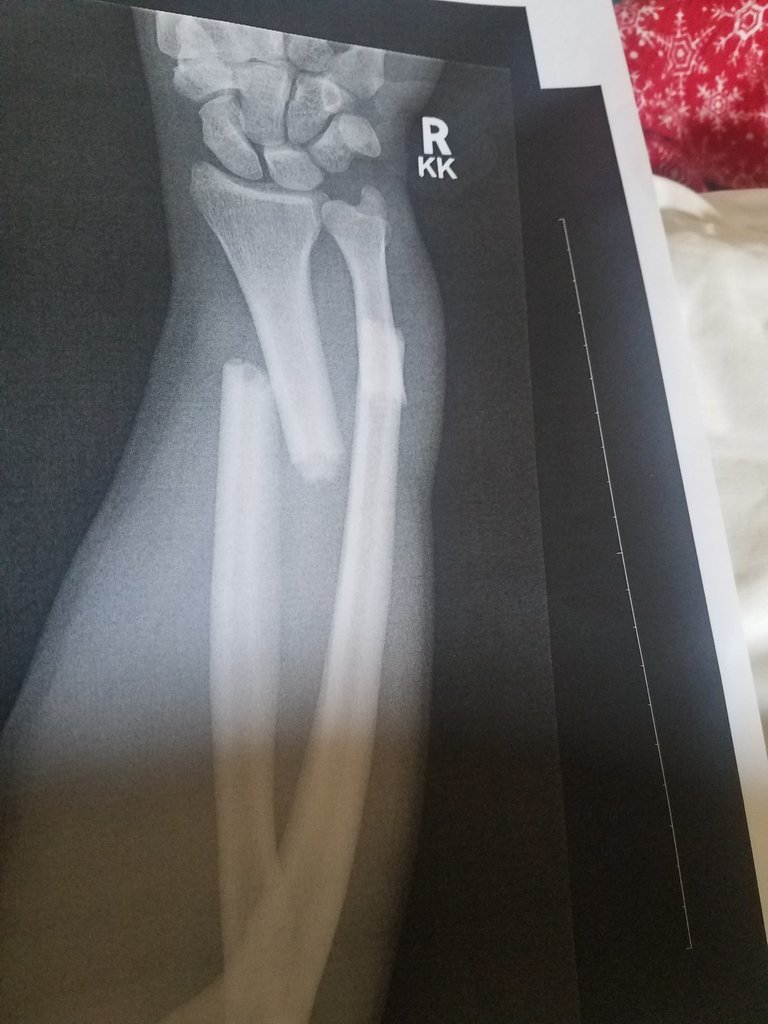 20170828_103635.jpg