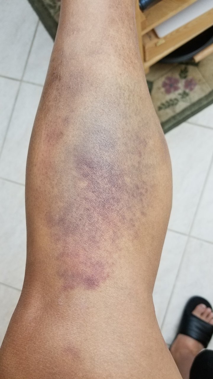 20171030_192225.jpg