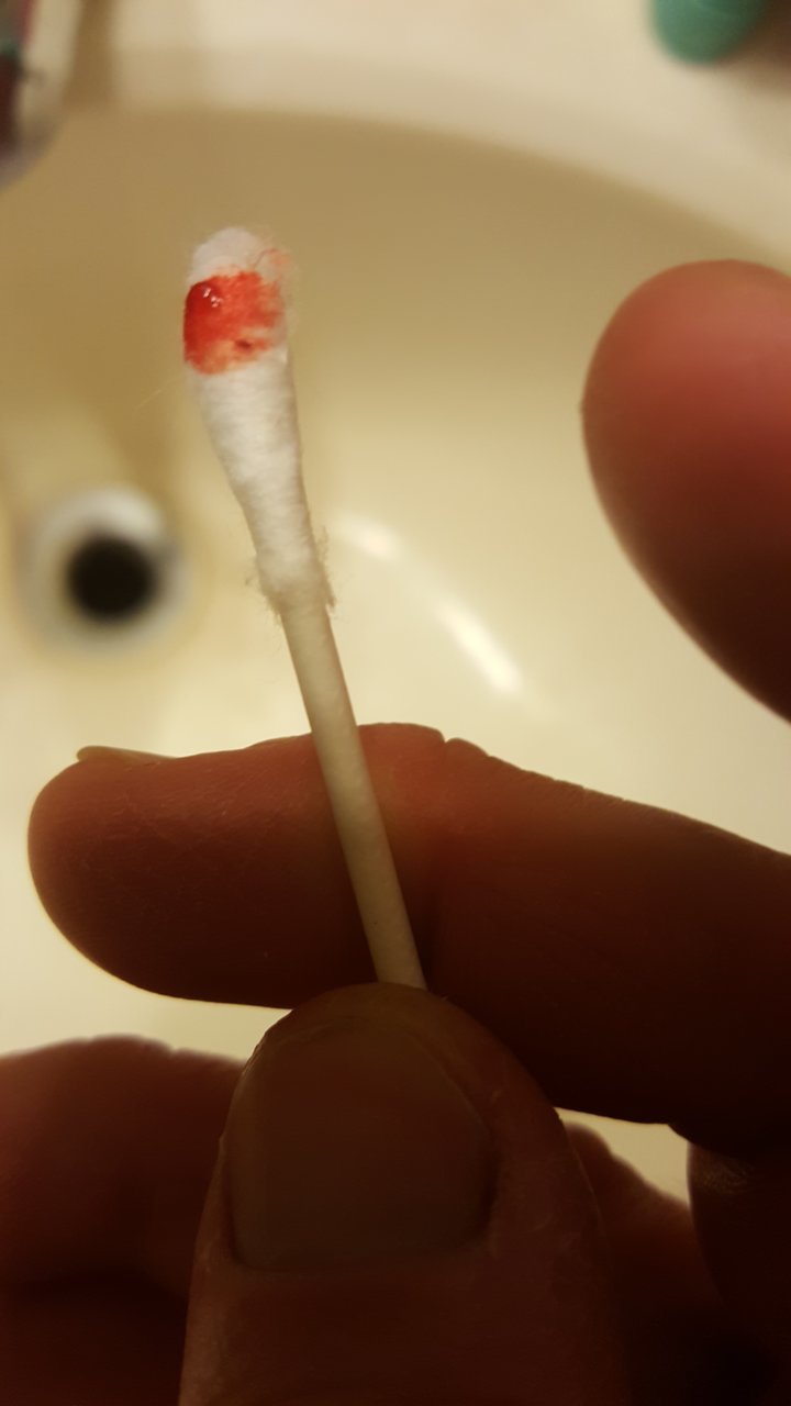 20180707_201746.jpg