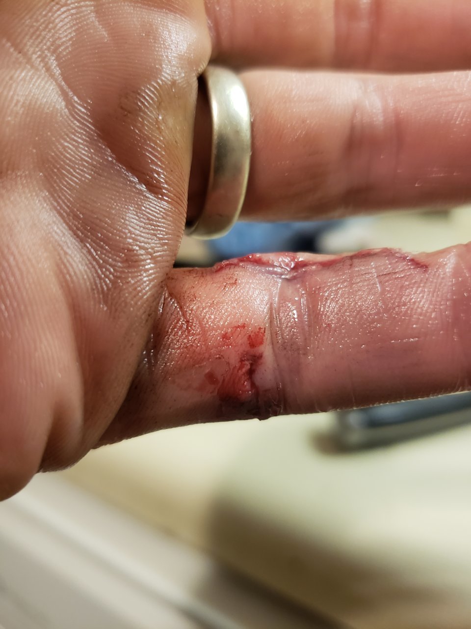 20180920_202542.jpg