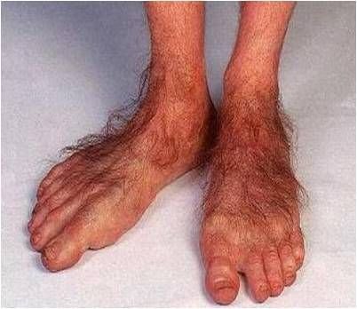 21c4c345b09fc30dc368a0556645cfcf--hobbit-feet-permanent-hair-removal.jpg