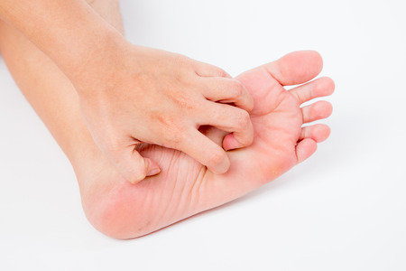 57261819_S_woman_rash_itch_foot_scratch_red_hand.jpg