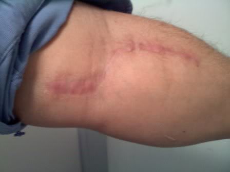 6monthsPO_bb2ddd894eb690fbf7143e78739818d2bd69e580.jpg