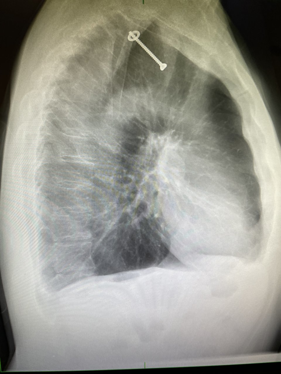 8D5A2DA8-18A4-4DAC-99CD-00F6FDA9F0A6.jpg