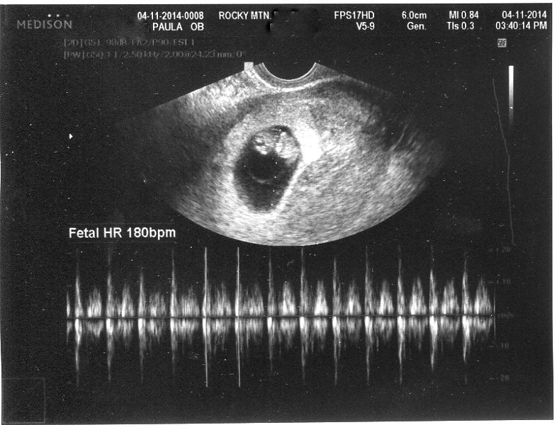 8weeks002_zps605149a5_d77efb8358a41b3733b3752697503ecc78368aa1.jpg