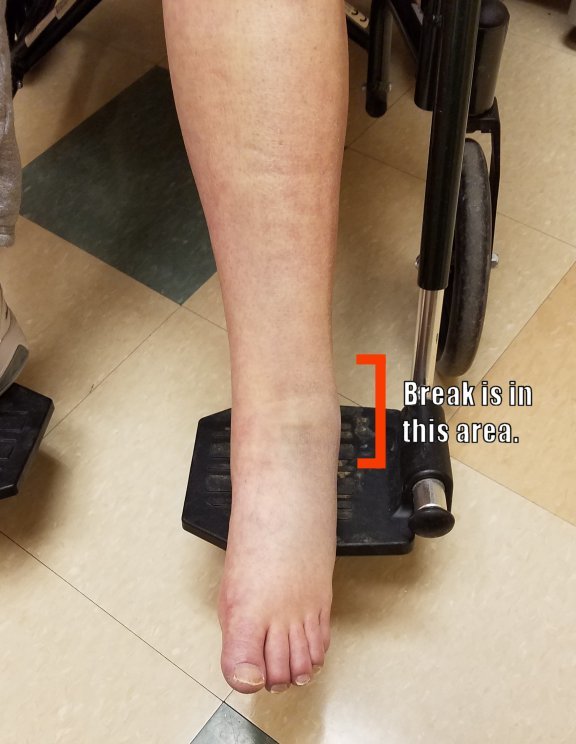 Ankle.jpg