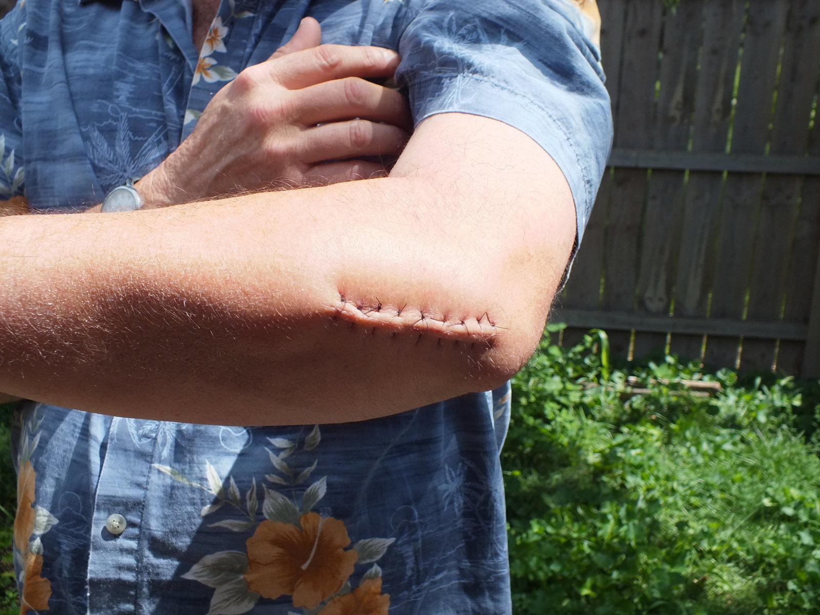 arm (2).jpg