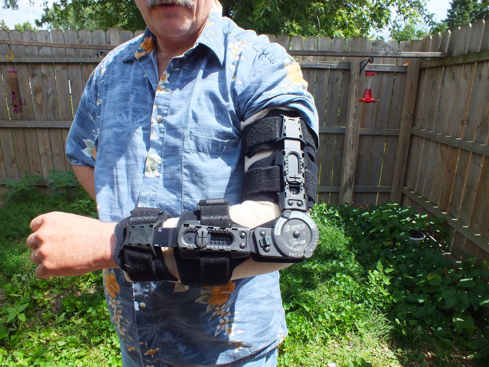 arm (3).jpg