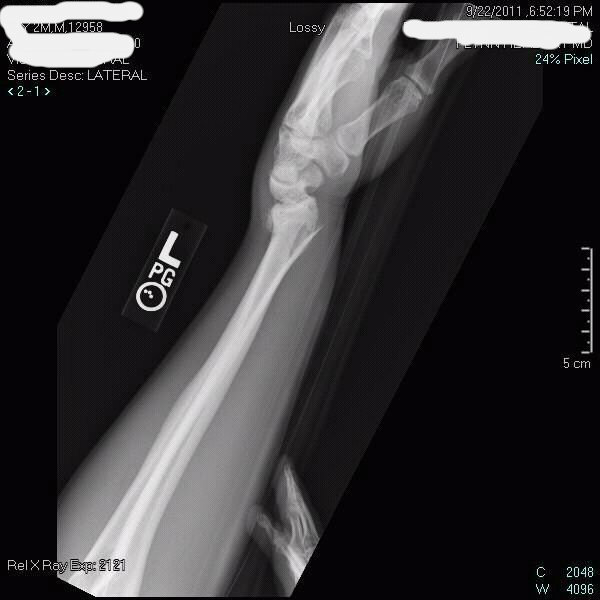 armxray_3653719e00438186c95bd52f366b016db644eedd.jpg