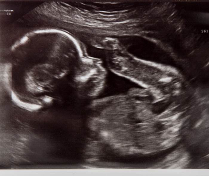 baby-5.jpg