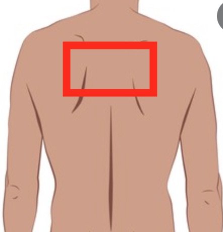 backpain.jpg