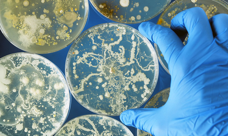 bacteria-petri-dish-3843923421.jpg