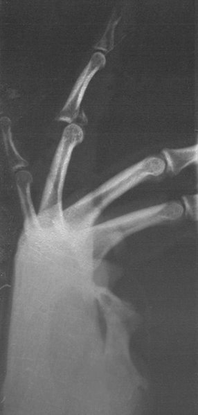 bones2.jpg