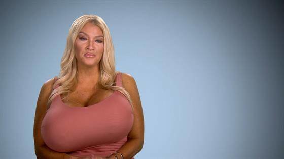 botched_418_highlight_a_274385_560x315_1_56cf35df96b23014ef3c43b7101970b1f51f1c02.jpg