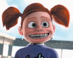 braces.jpg