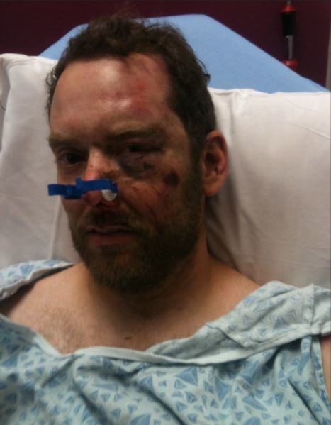 broken face 1.jpg
