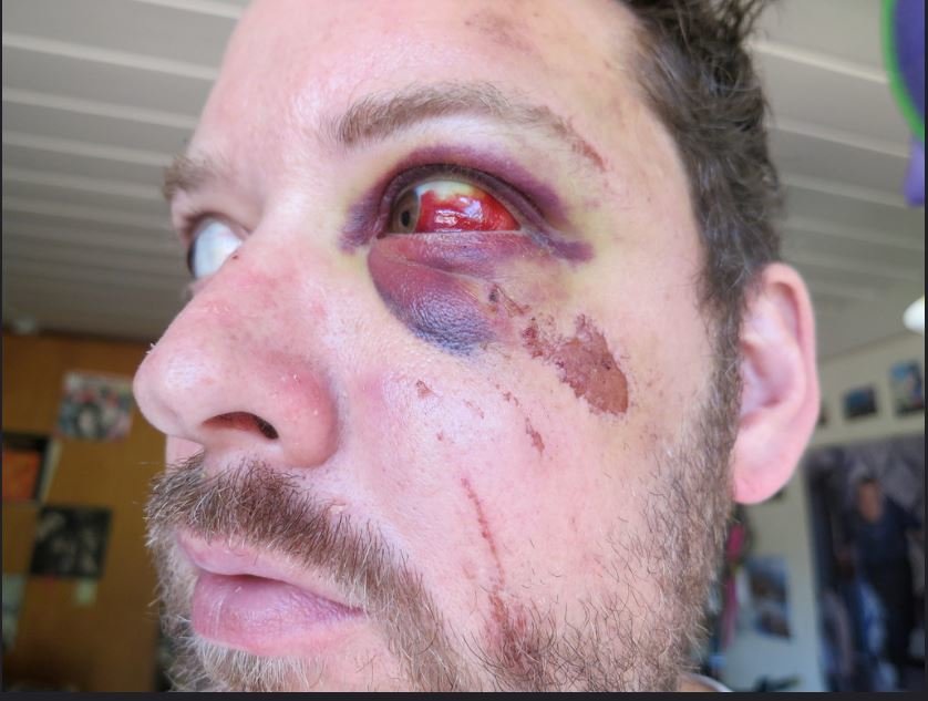 broken face 2.jpg