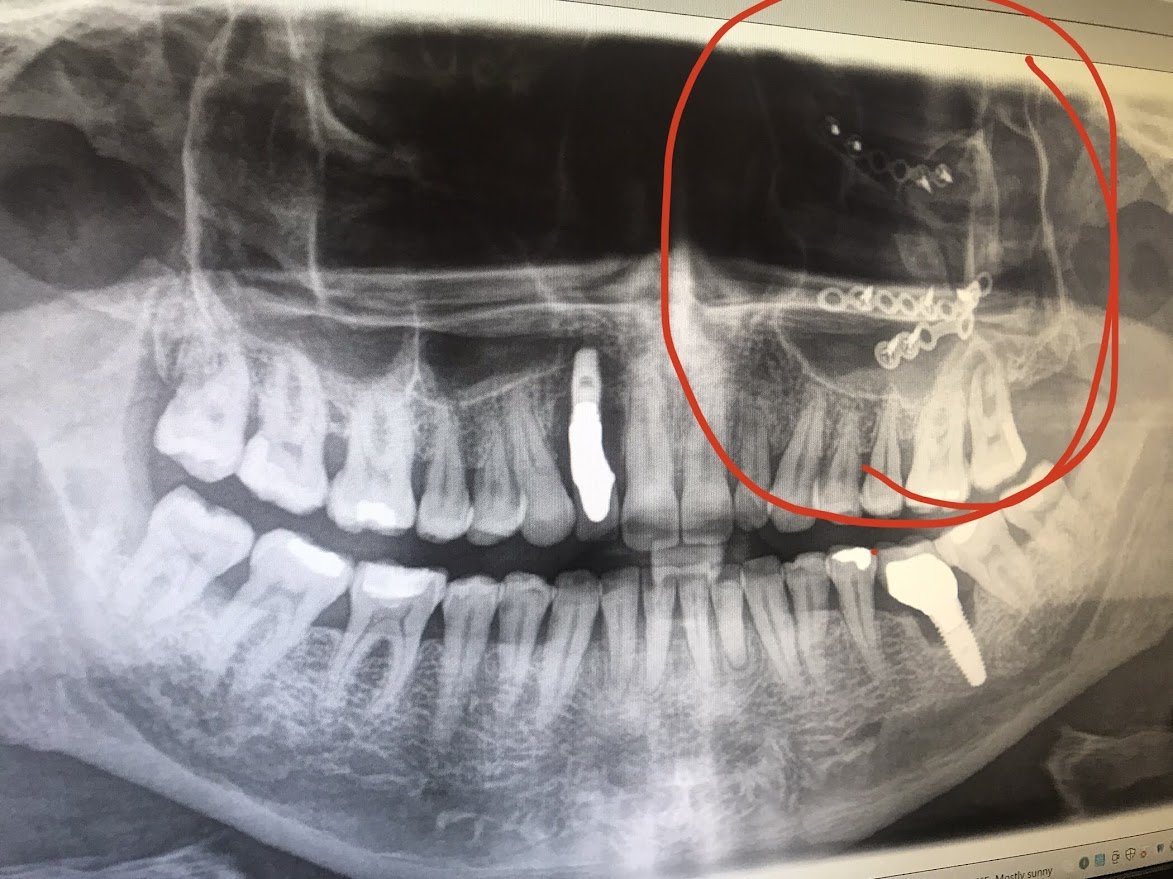 broken face 3.jpg