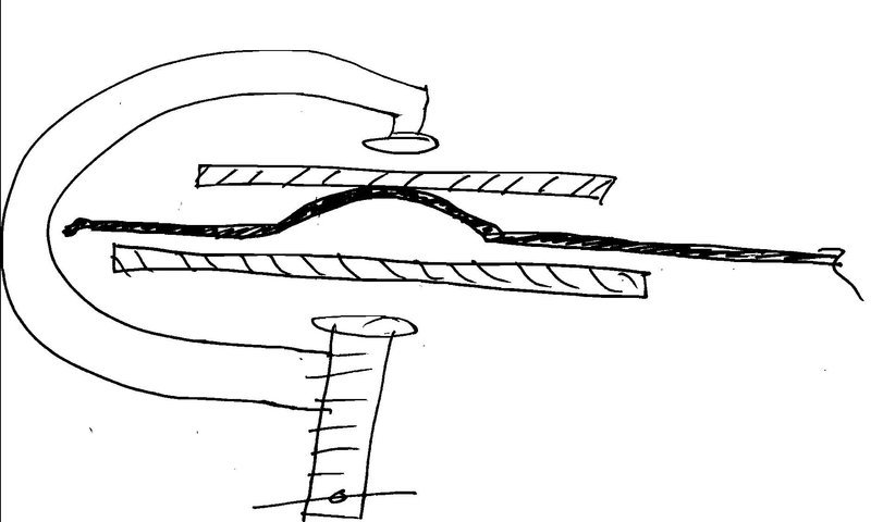 c-clamp method.jpg