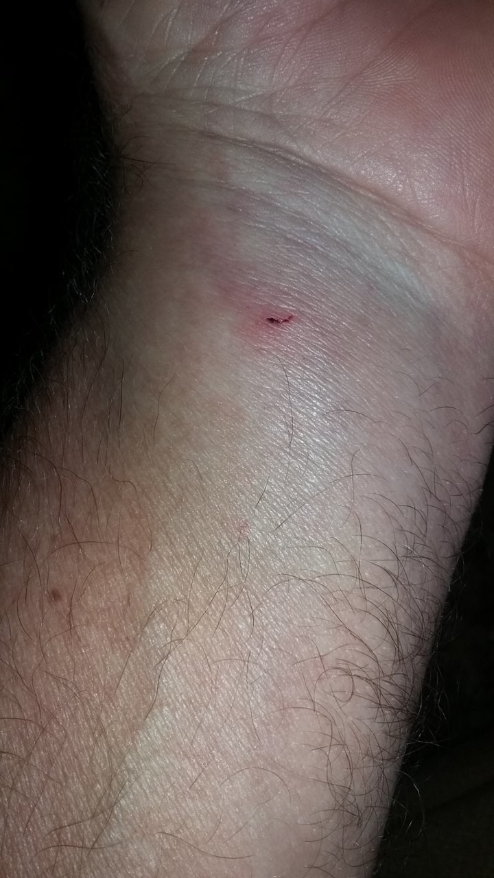 cat scratch .jpg