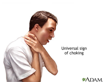 choke.jpg