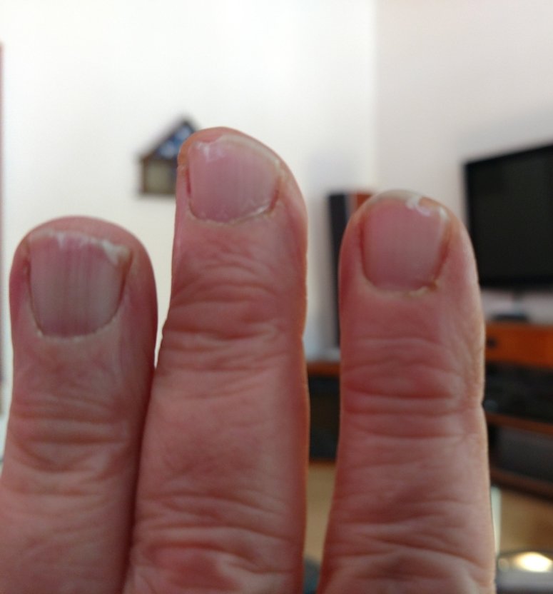 cold nails.jpg