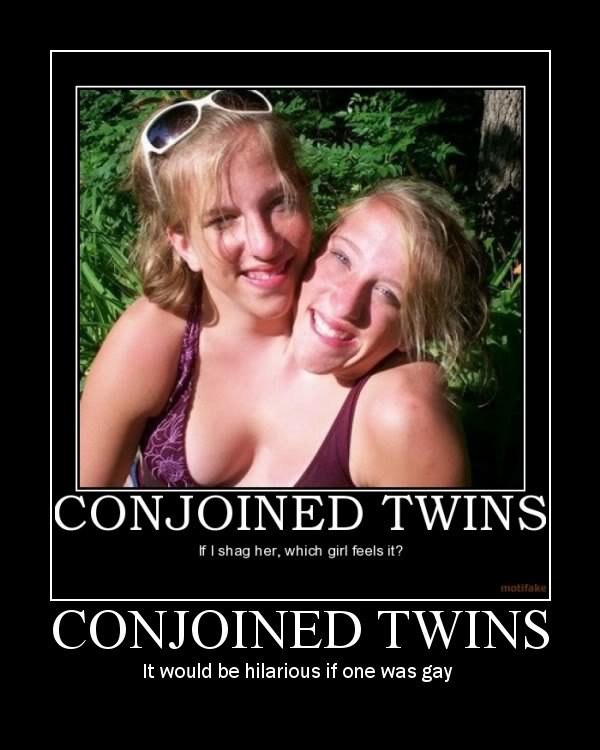 ConjoinedTwins_3139bd19ff0a0eaa15fa509c776d0ebd831293f9.jpg