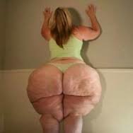 cottage-cheese-butt.jpg.jpg
