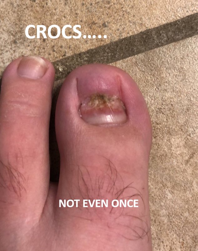 crocs.jpg