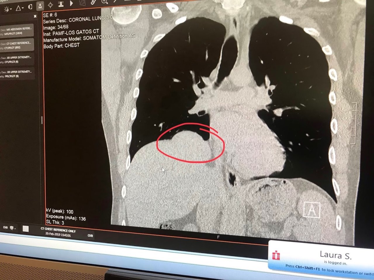 CT1.jpg