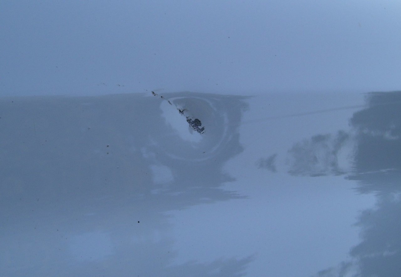 dent1.jpg