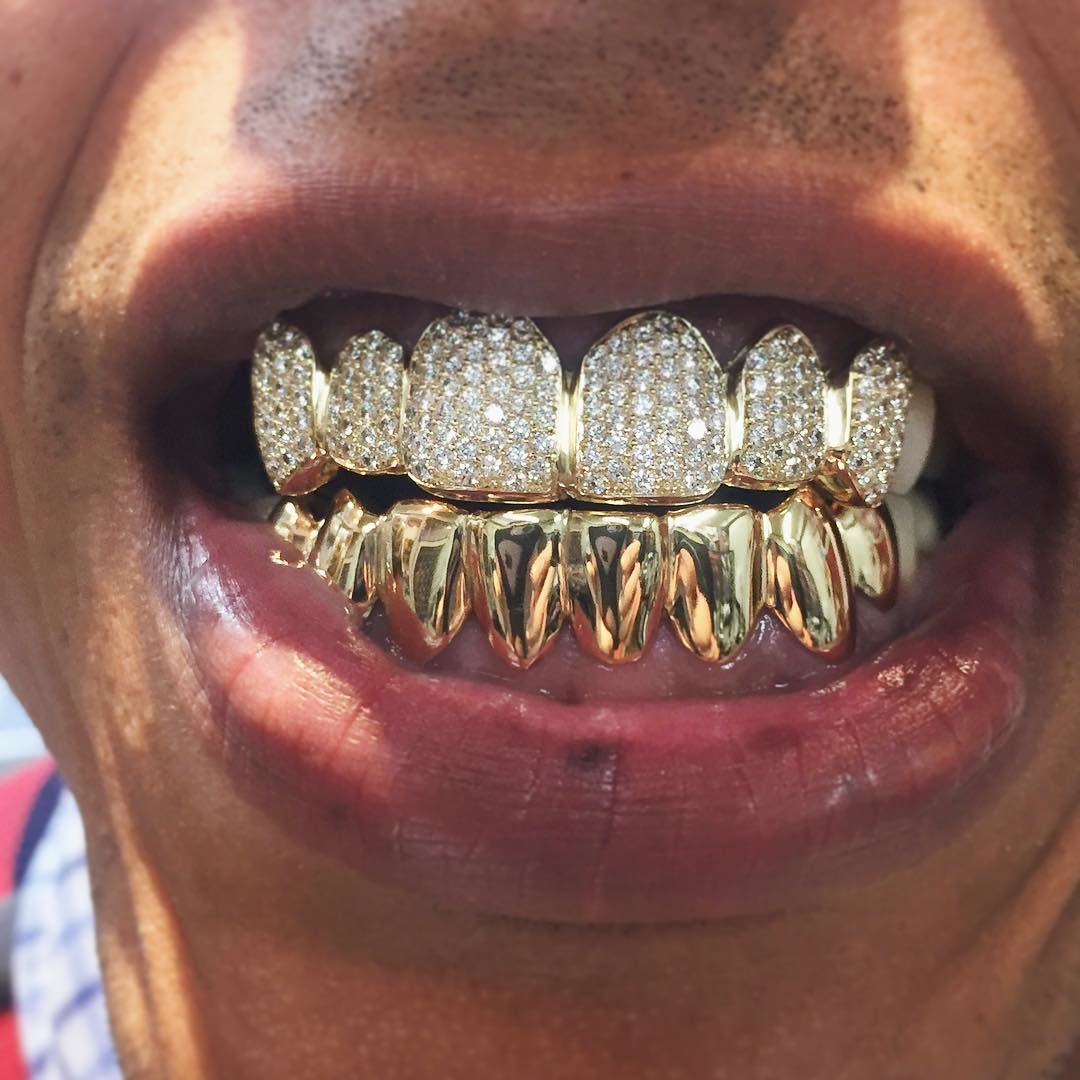 DiamondGrillzFRONTVIEW.jpg