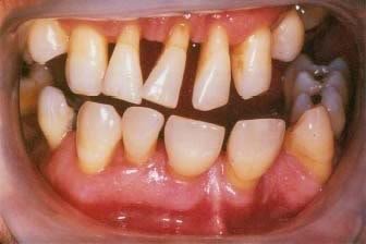 disease_ed1e46a4fc9e2f6eb6b4f26a5e2264a653e36b3c.jpg