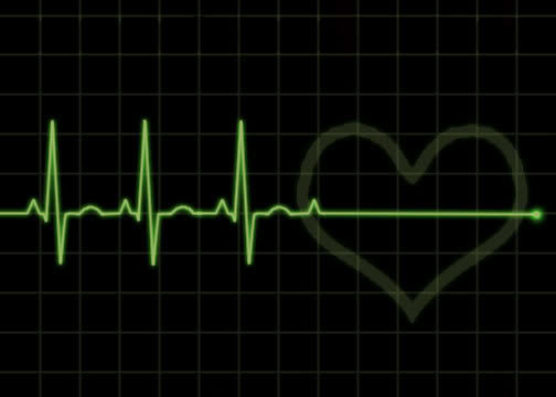 EKG-Flatline.jpg