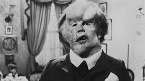 Elephant Man.jpg
