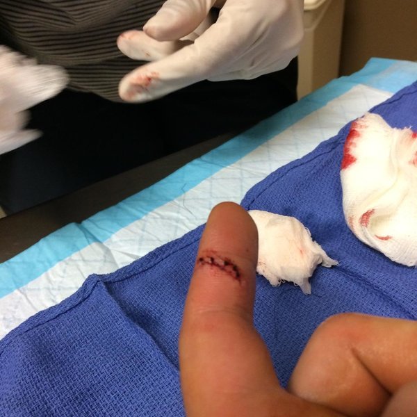finger.jpg