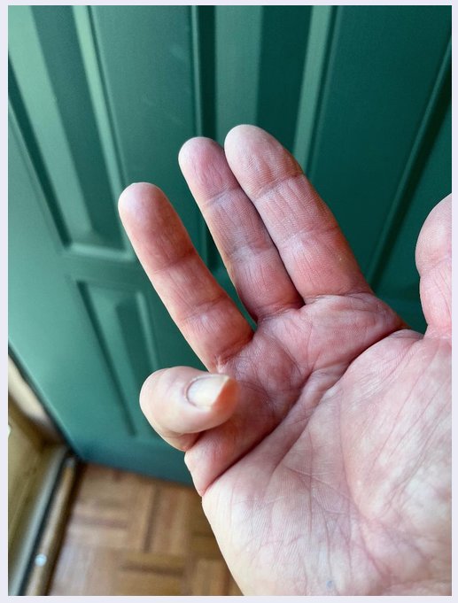 Finger.png