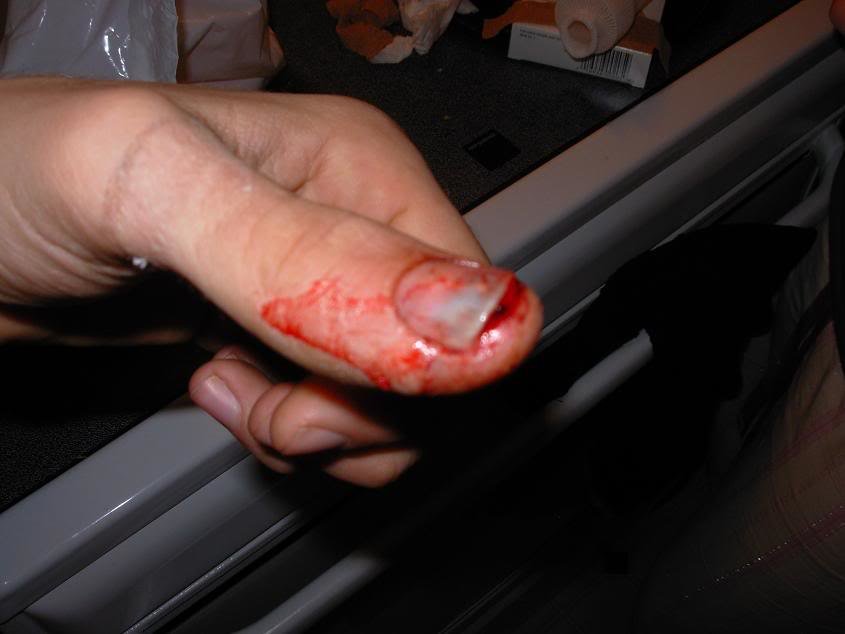 finger_6b40a3ad603936de60db5b07714587464936bec4.jpg