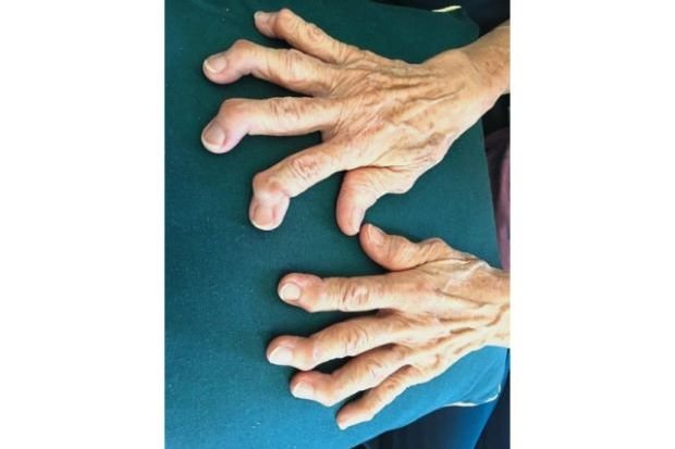 fingers.jpg