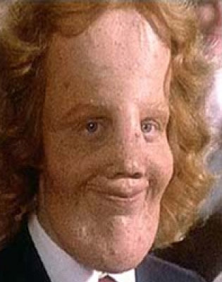 forehead-rockydennis.jpg