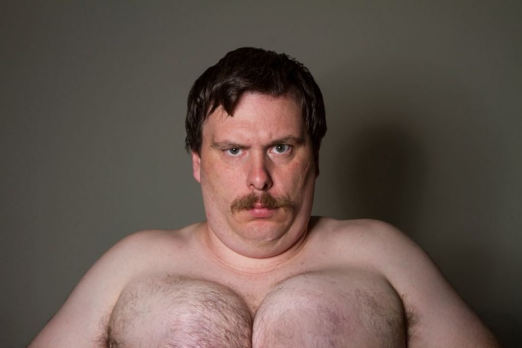 get-rid-of-chest-fat-1024x683.jpg