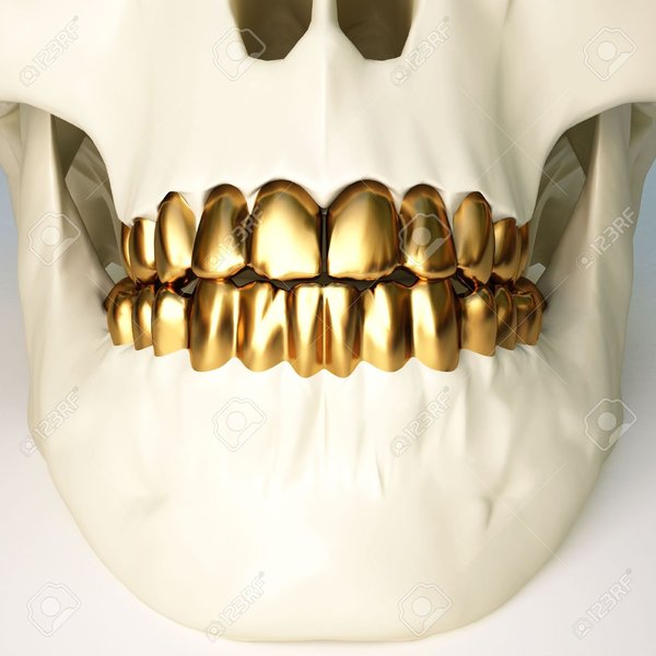 Gold Teeth.jpg
