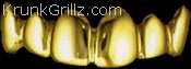 goldteeth_daa528dd94c8a87358a4ad68278938e6100be8c9.jpg
