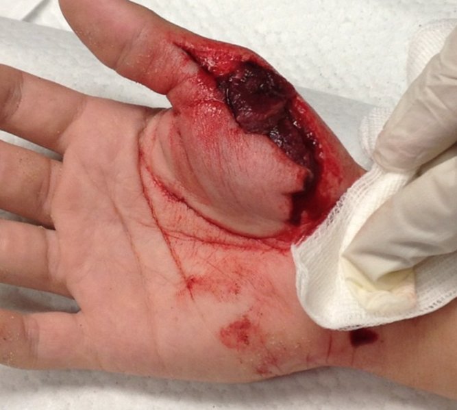 Grant's Hand 2.jpg