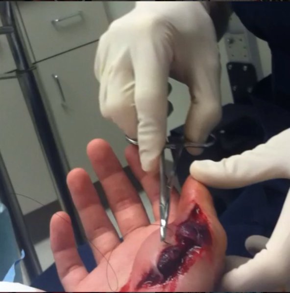Grants Hand.jpg